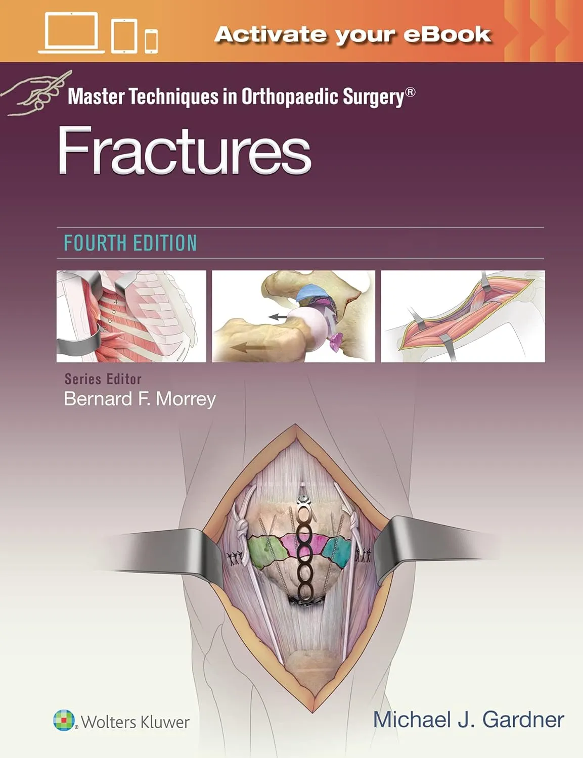 Master Techniques In Orthopaedic Surgery Fractures 4th Edition | Hardcover