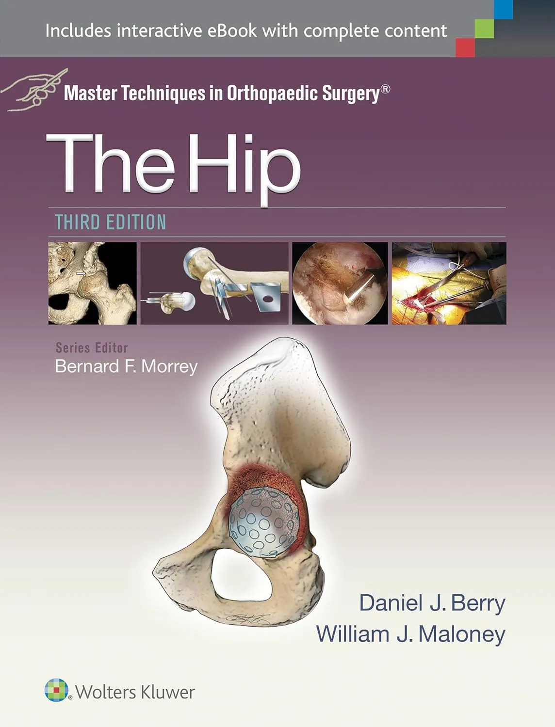 Master Techniques in Orthopaedic Surgery The Hip | Third Edition | Hardcover