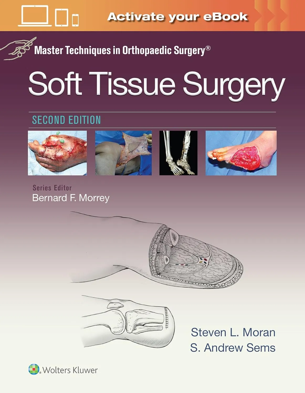 Master Techniques in Orthopaedic Surgery Soft Tissue Surgery | 2nd Edition | Hardcover