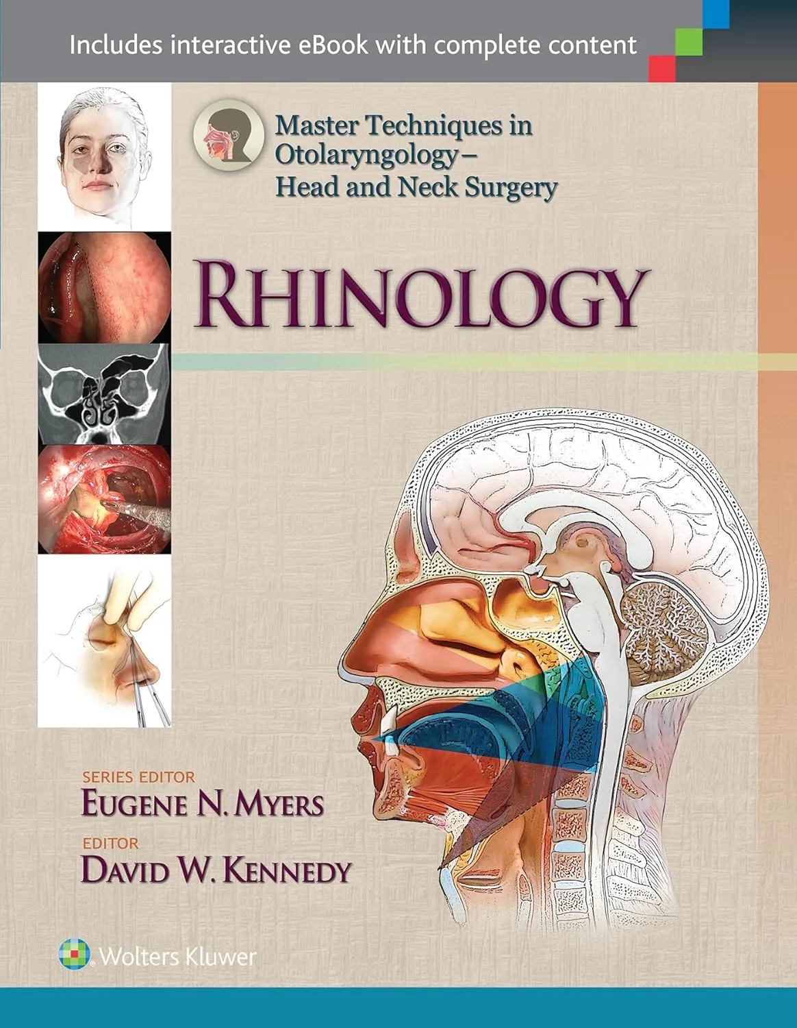 Master Techniques in Otolaryngology Head and Neck Surgery RHINOLOGY | Hardcover