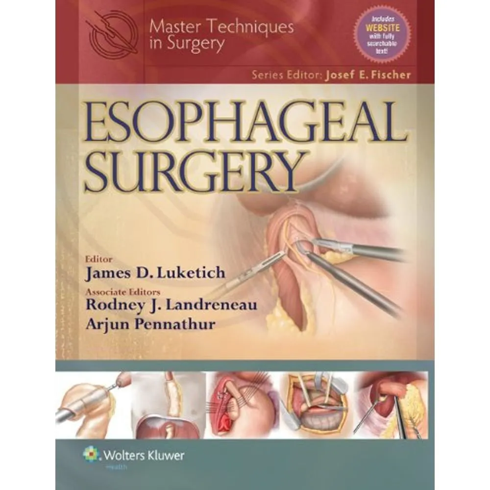 Master Techniques in Surgery- Esophageal Surgery | Hardcover