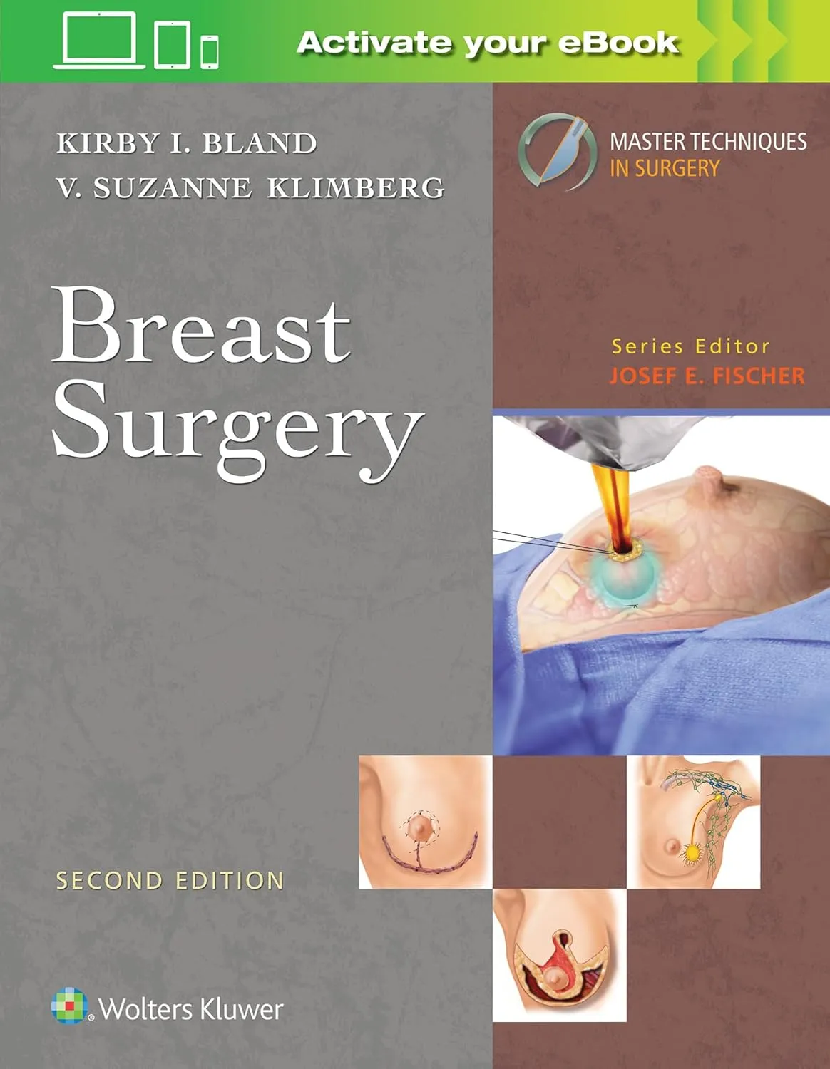 Master Techniques in Surgery Breast Surgery | 2nd Edition | Hardcover