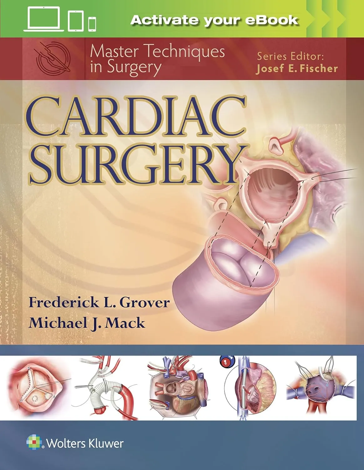 Master Techniques in Surgery Cardiac Surgery | Hardcover