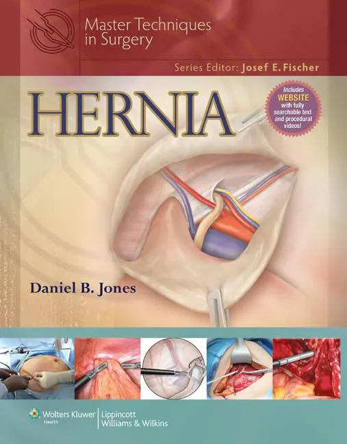 Master Techniques in Surgery Hernia | Hardcover
