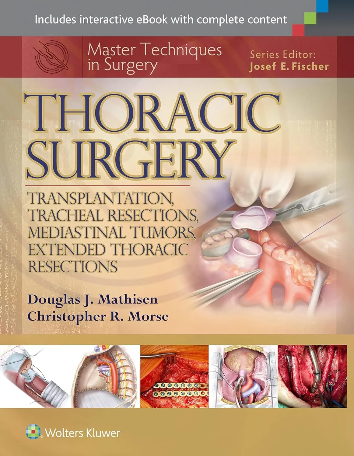 Master Techniques in Surgery Thoracic Surgery | Hardcover
