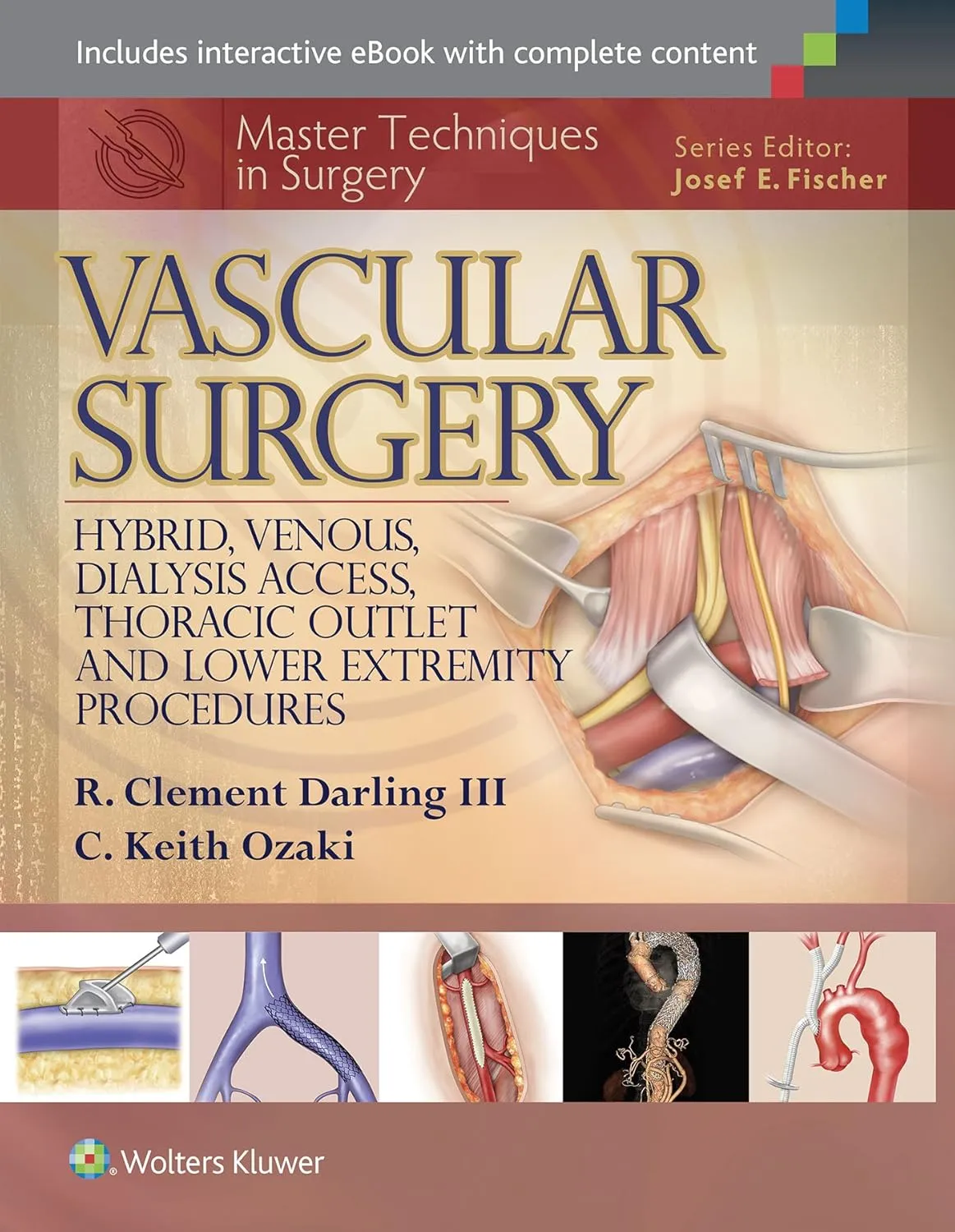 Master Techniques in Surgery Vascular Surgery Hybrid | Venous | Dialysis Access | Thoracic Outlet and Lower Extremity Procedures | Hardcover
