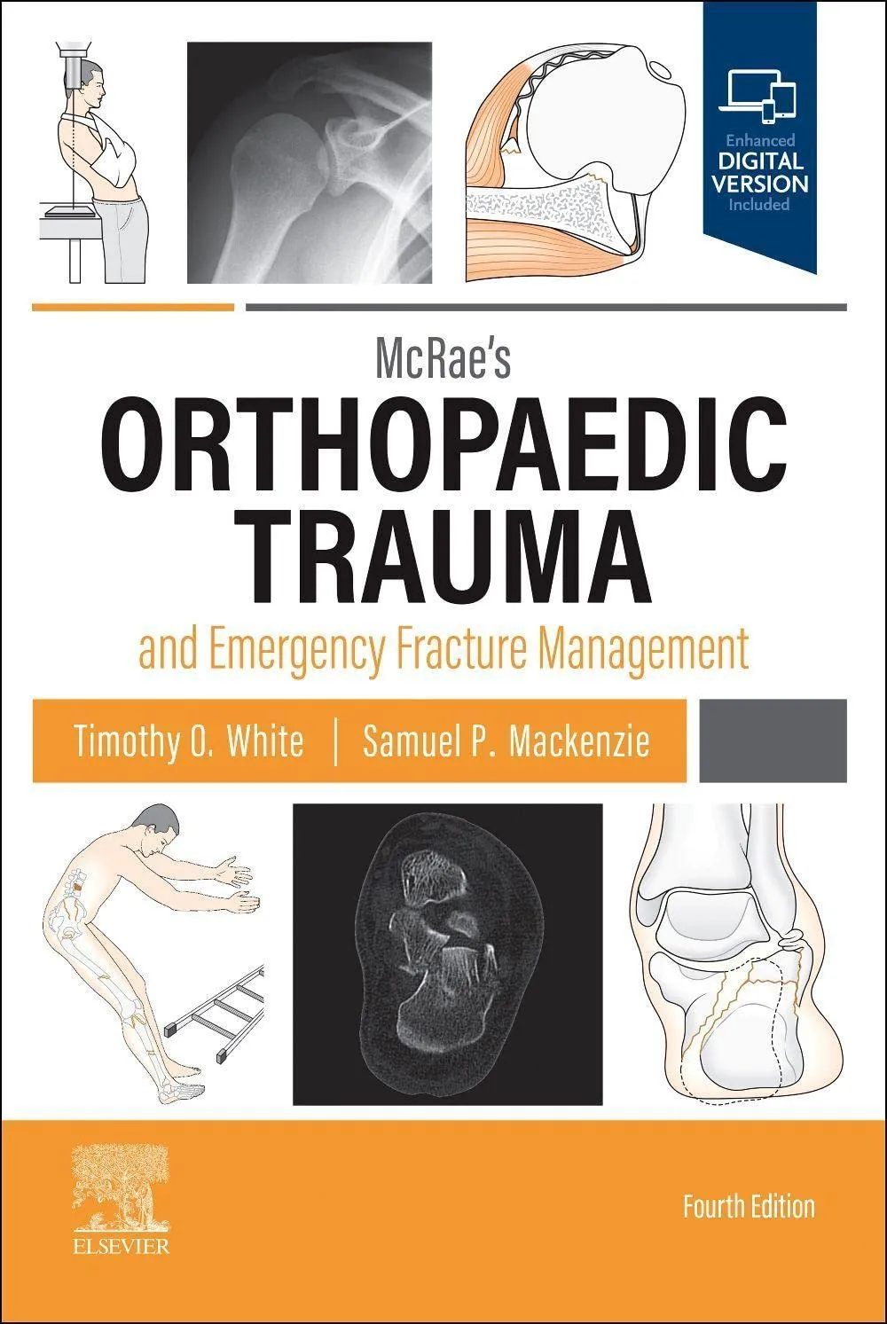 Mcraes Orthopaedic Trauma And Emergency Fracture Management With Access Code 4th Edition | Paperback
