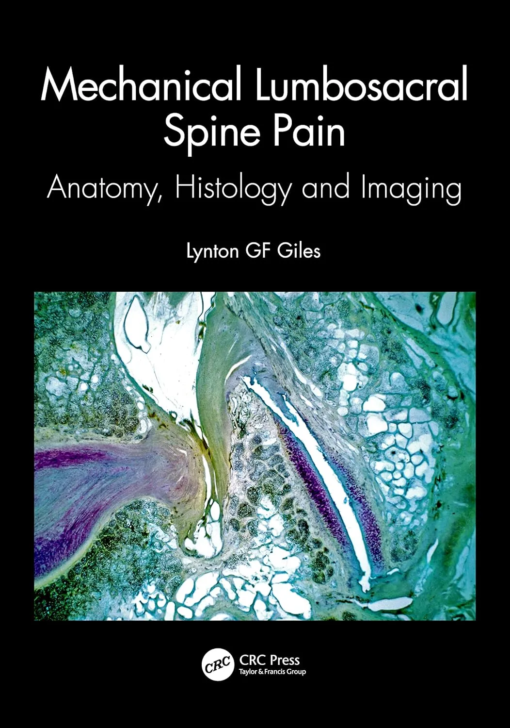Mechanical Lumbosacral Spine Pain Anatomy Histology And Imaging | Paperback