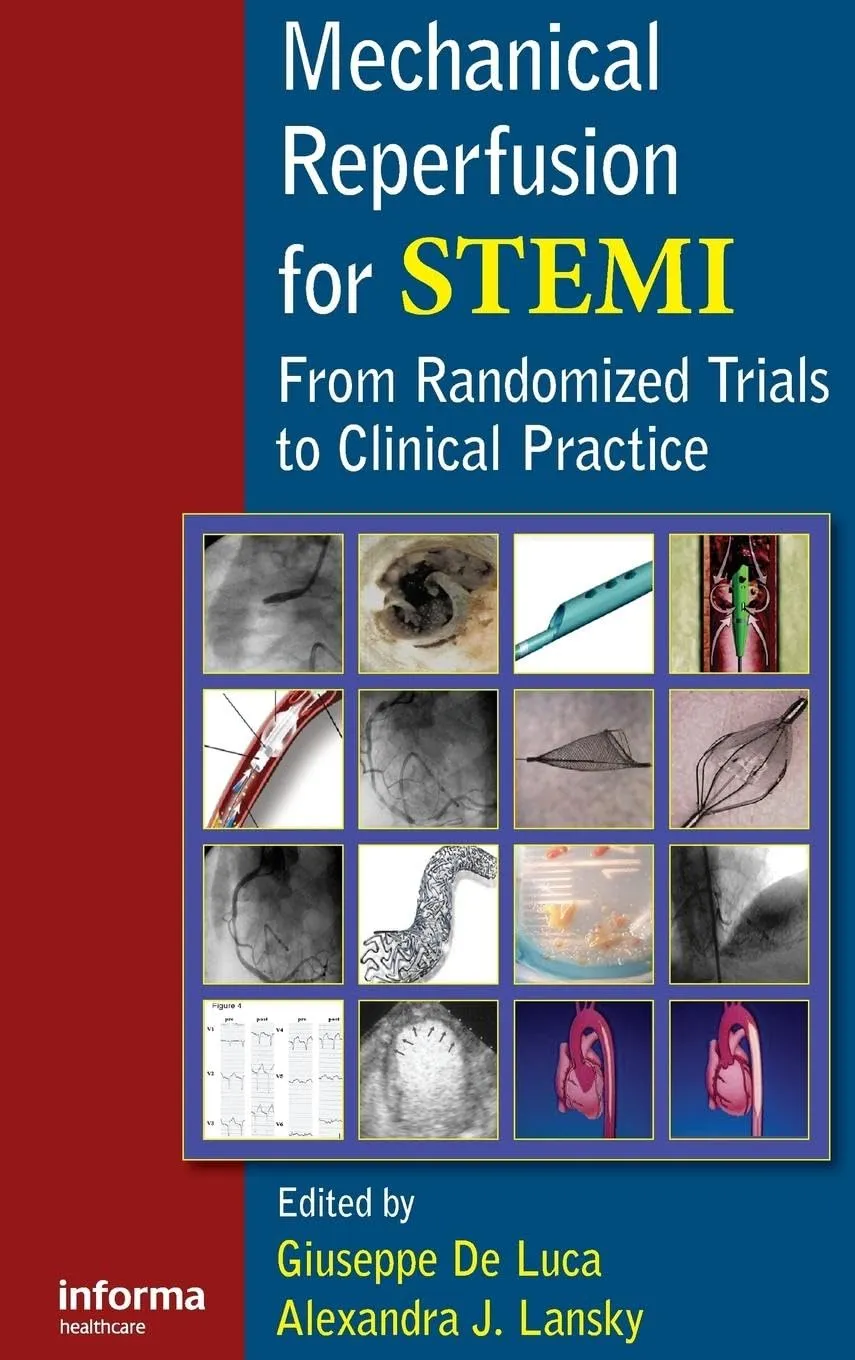 Mechanical Reperfusion for STEMI From Randomized Trials to Clinical Practice | Hardcover