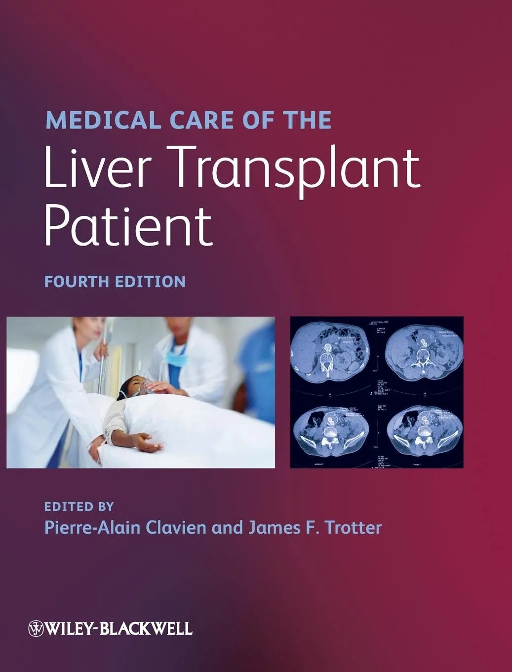 Medical Care of the Liver Translant Patient | 4th Edition | Hardcover