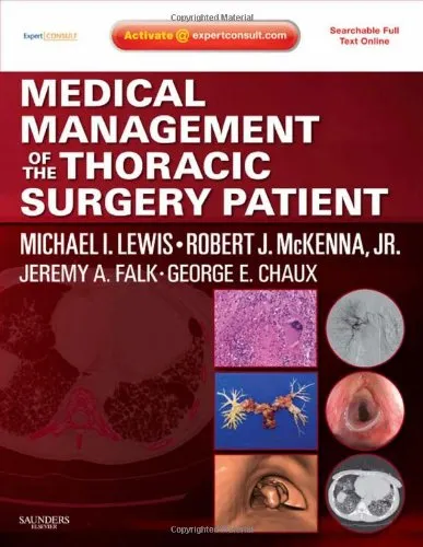 Medical Management of the Thoracis Surgery Patient | Hardcover