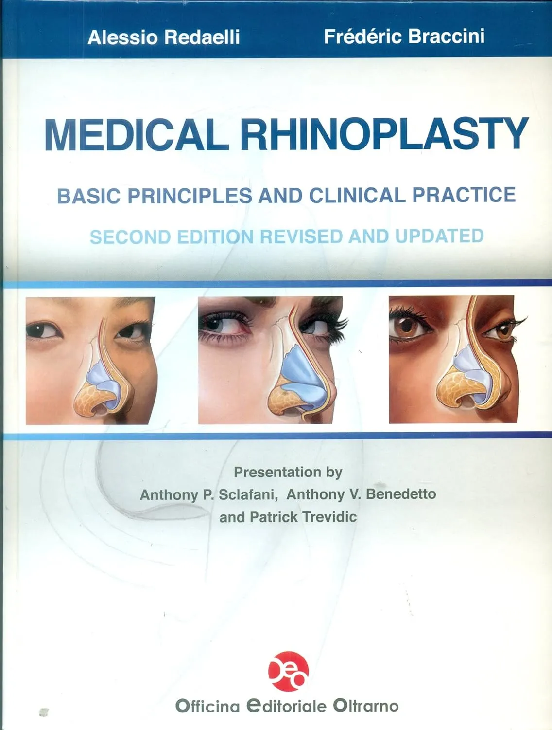 Medical Rhinoplasty Basic Principles and Clinical Practice | 2nd Edition | Hardcover