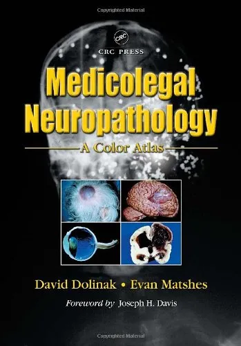 Medicolegal Neuropathology A Color Atlas (Hb 2002)