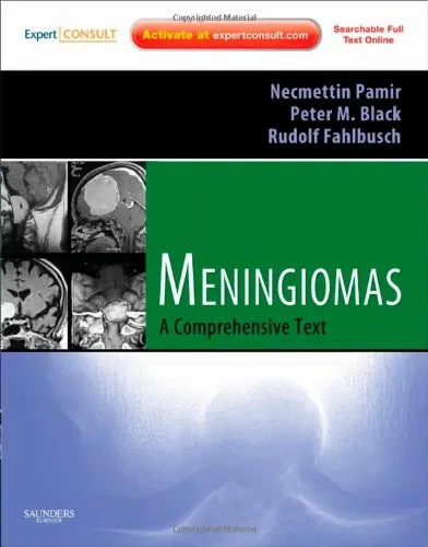 Meningiomas Expert Consult - Online and Print | Hardcover