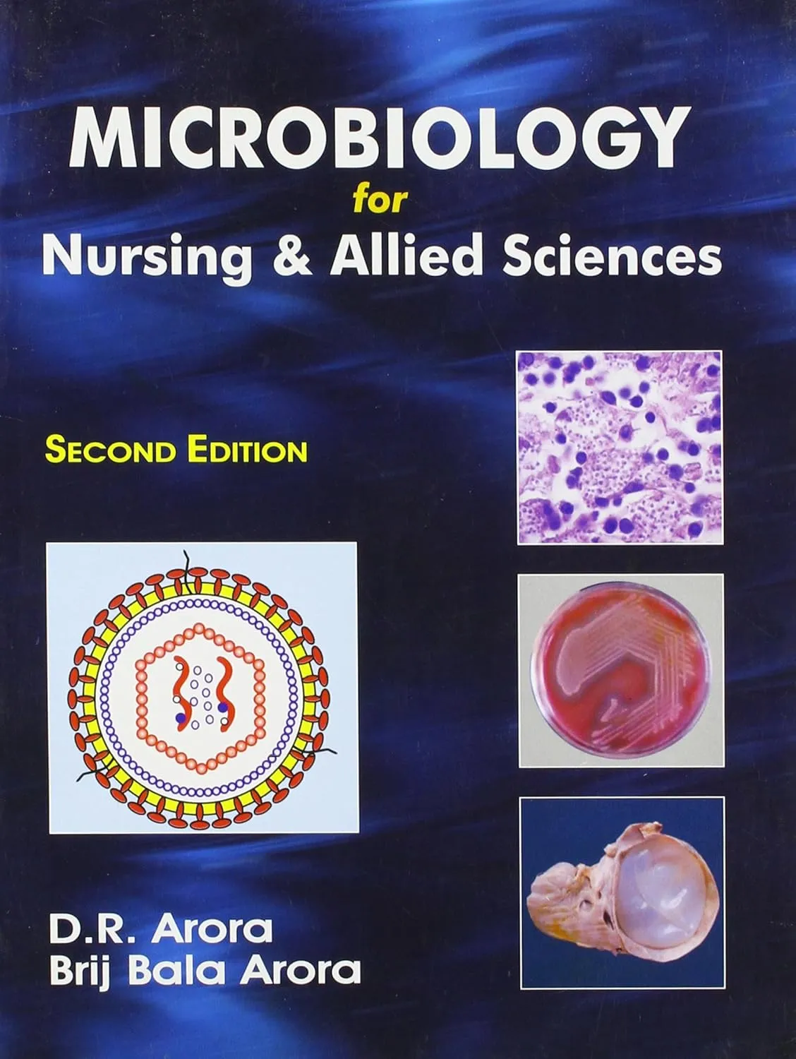 Microbiology for Nursing and Allied Sciences | 2nd Edition | Paperback