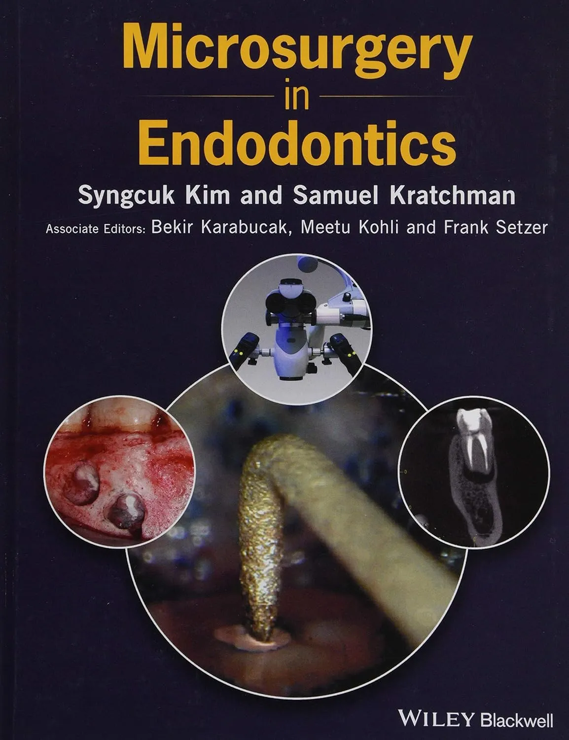 Microsurgery in Endodontics | Hardcover