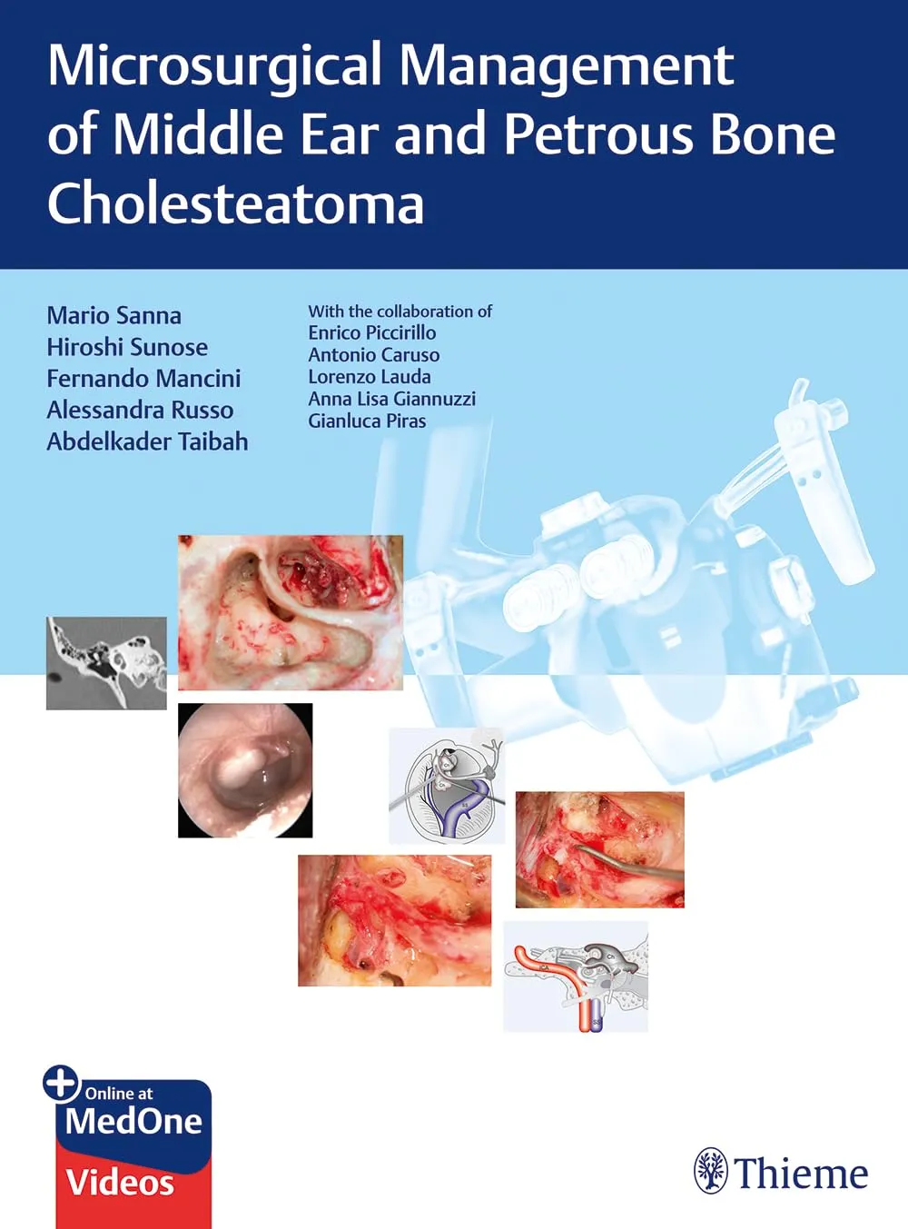 Microsurgical Management of Middle Ear and Petrous Bone Cholesteatoma | Hardcover