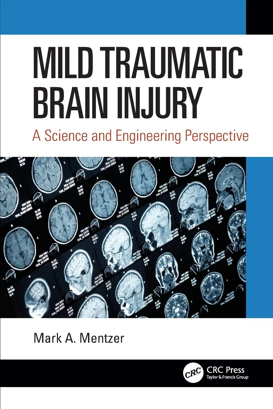 Mild Traumatic Brain Injury A Science And Engineering Perspective | Paperback