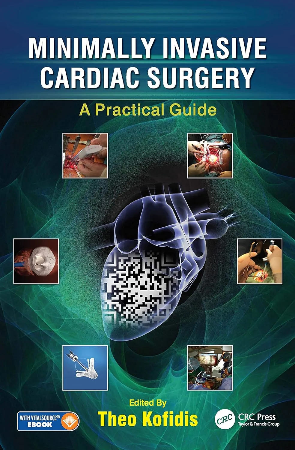 Minimally Invasive Cardiac Surgery A Practical Guide | Hardcover