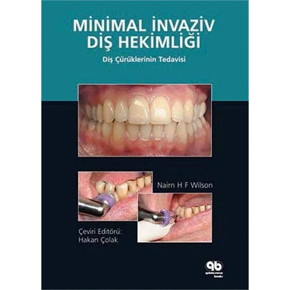 Minimally Invasive Dentistry The Management of Caries | Hardcover