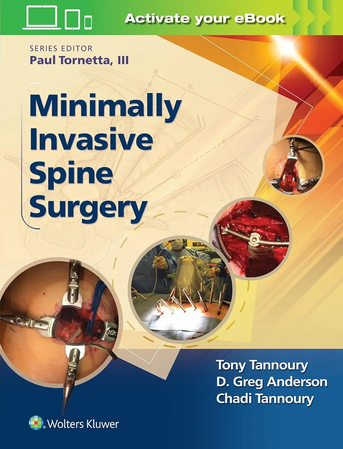 Minimally Invasive Spine Surgery | Hardcover