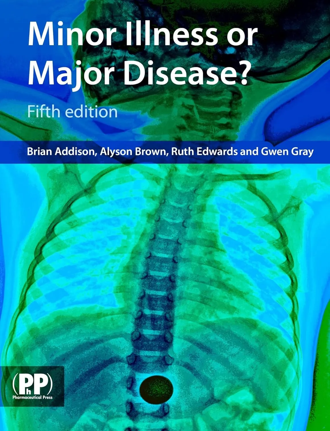 Minor Illness or Major Disease? | Paperback
