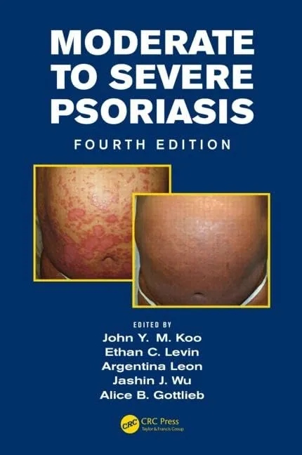 Moderate to Severe Psoriasis | 4th Edition | Hardcover