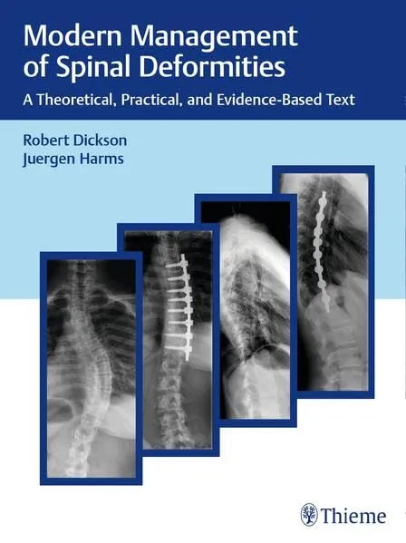 Modern Management of Spinal Deformities | Hardcover