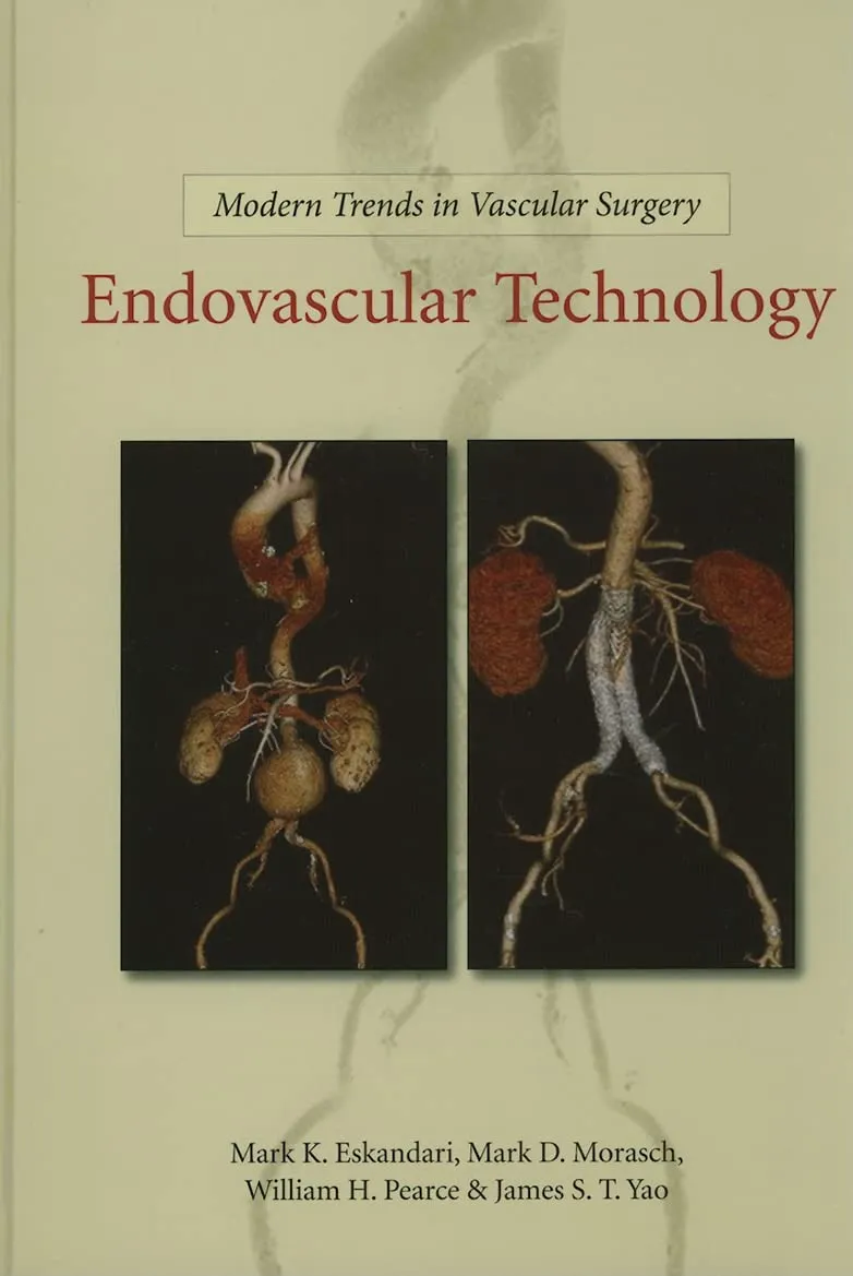 Modern Trends in Vascular Surgery Endovascular Technology | Hardcover