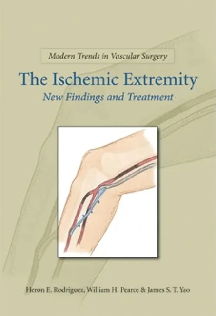 Modern Trends in Vascular Surgery The Ischemic Extremity New Findings and Treatment | Hardcover