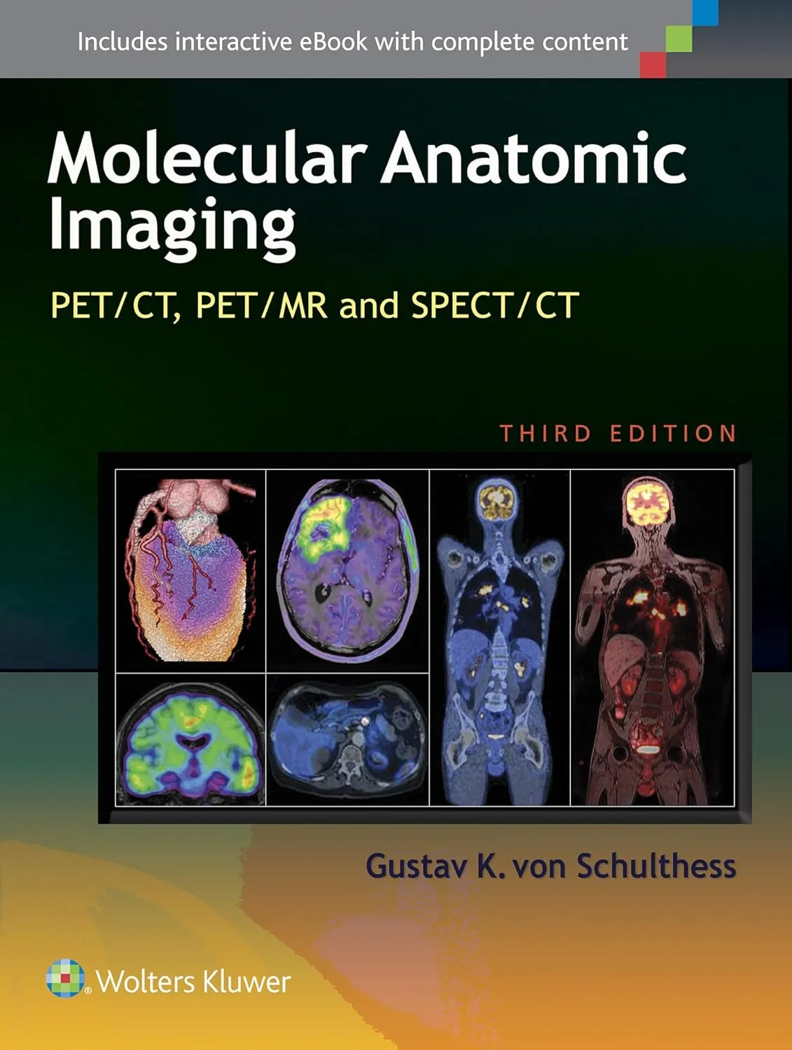 Molecular Anatomic Imaging PET/CT | PET/MR and SPECT/CT | Hardcover