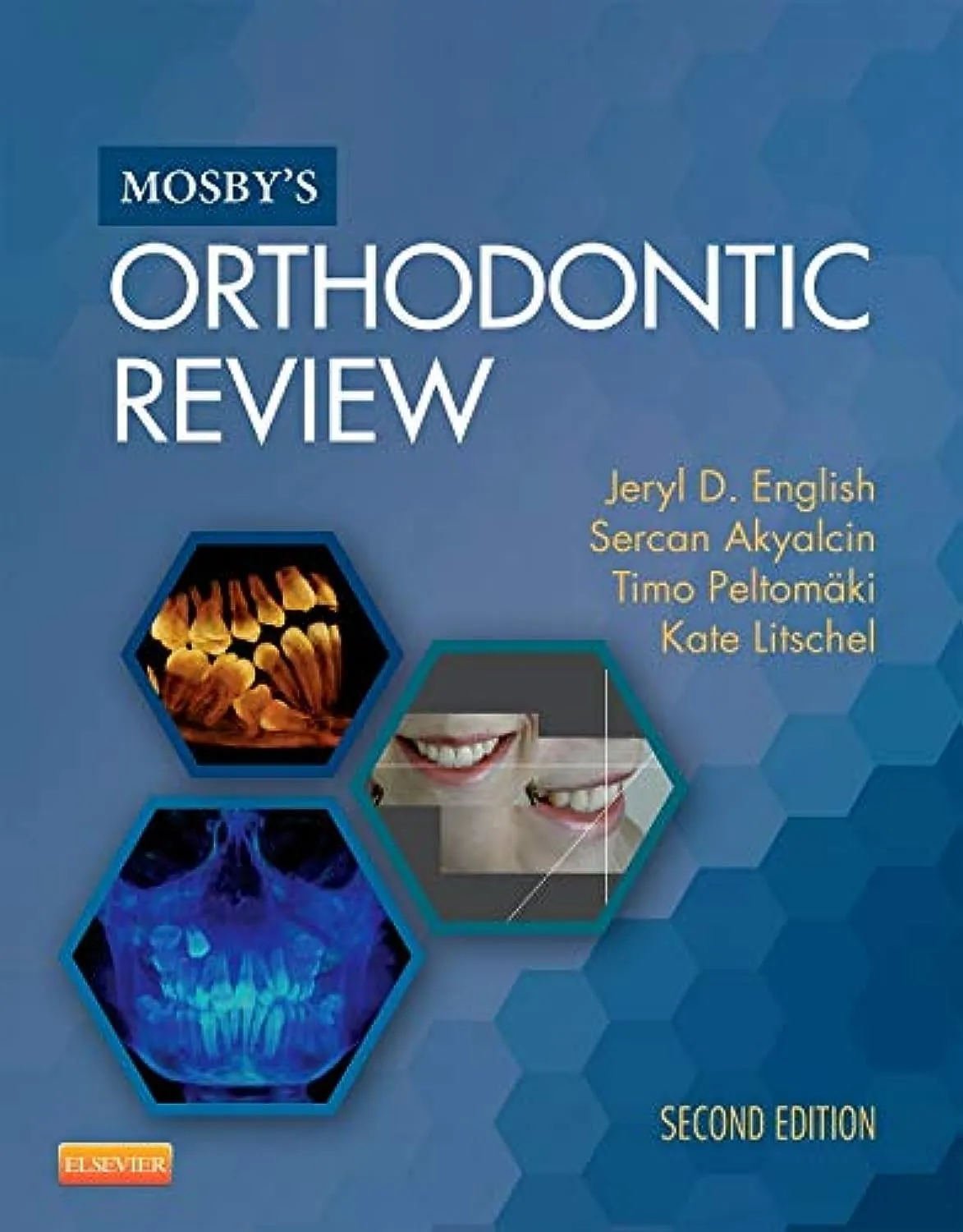 Mosby's Orthodontic Review | 2nd Edition | Paperback
