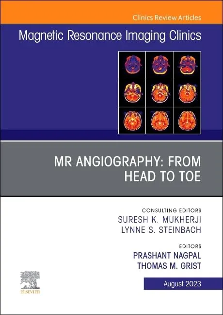 MR Angiography From Head To Toe An Issue Of Magnetic Resonance Imaging Clinics Of North America | Hardcover
