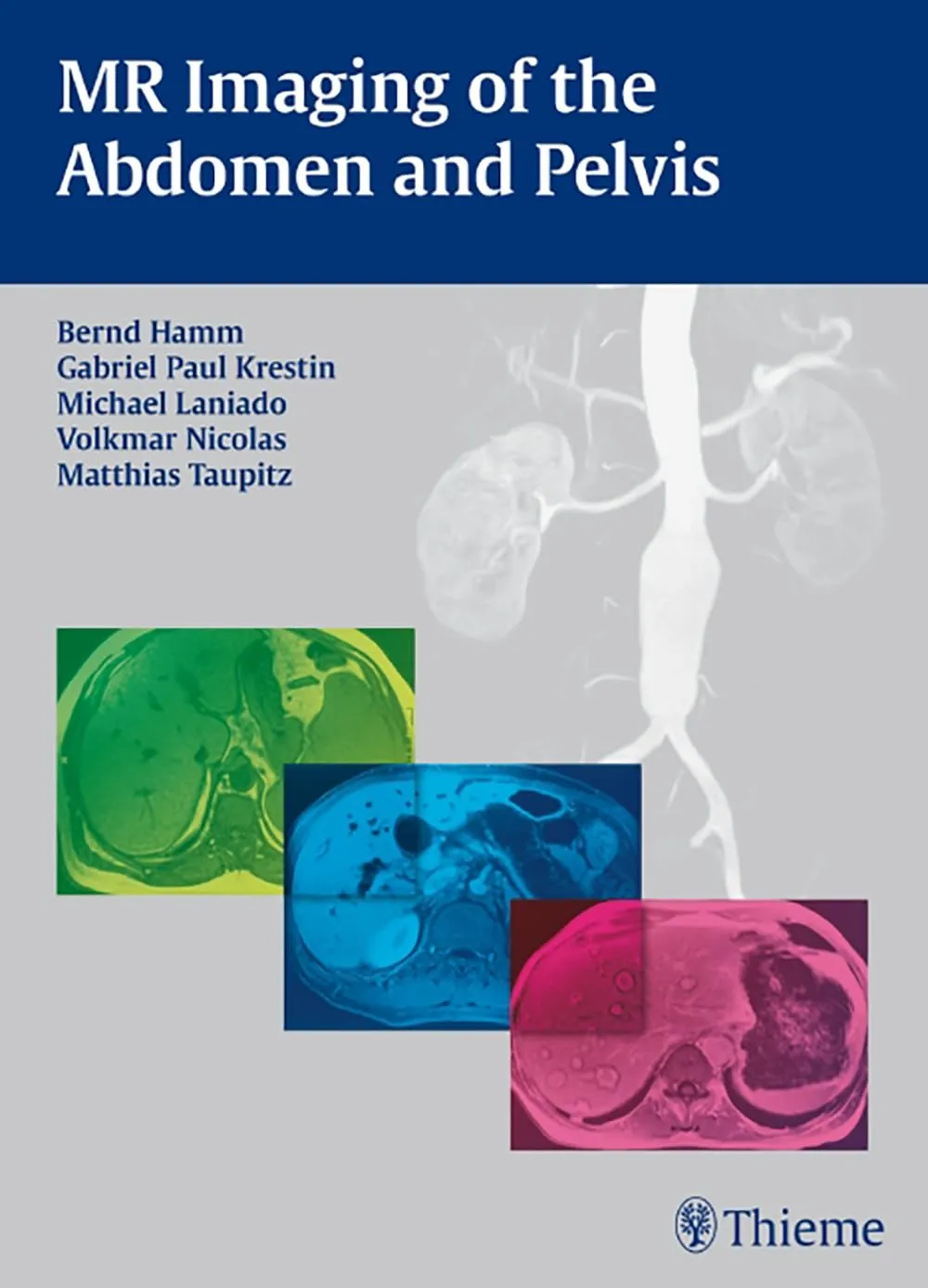MR Imaging of the Abdomen and Pelvis | Hardcover