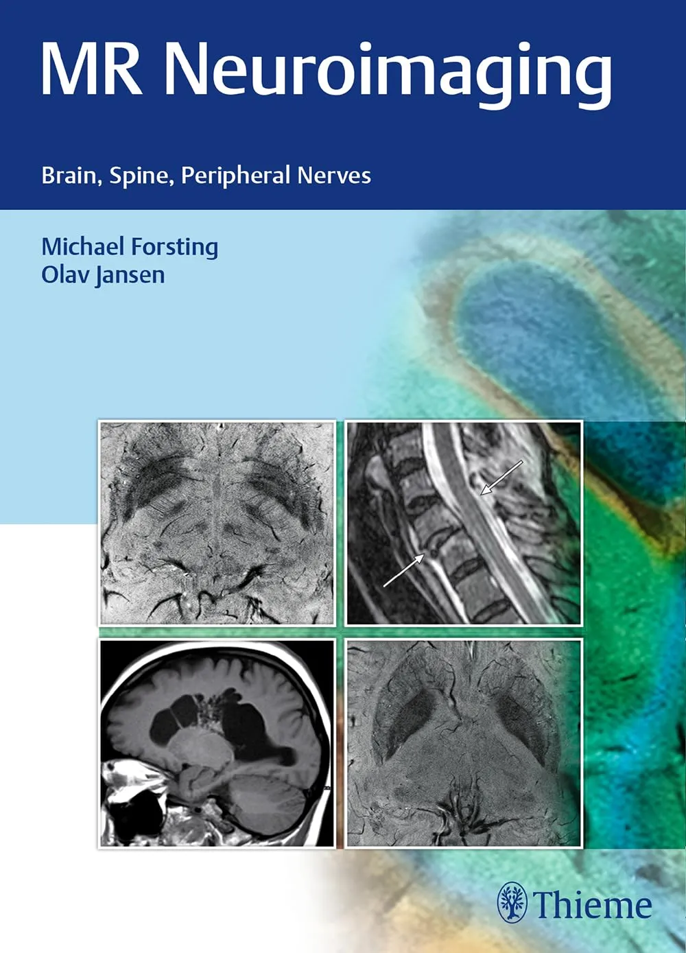 MR Neuroimaging | Hardcover