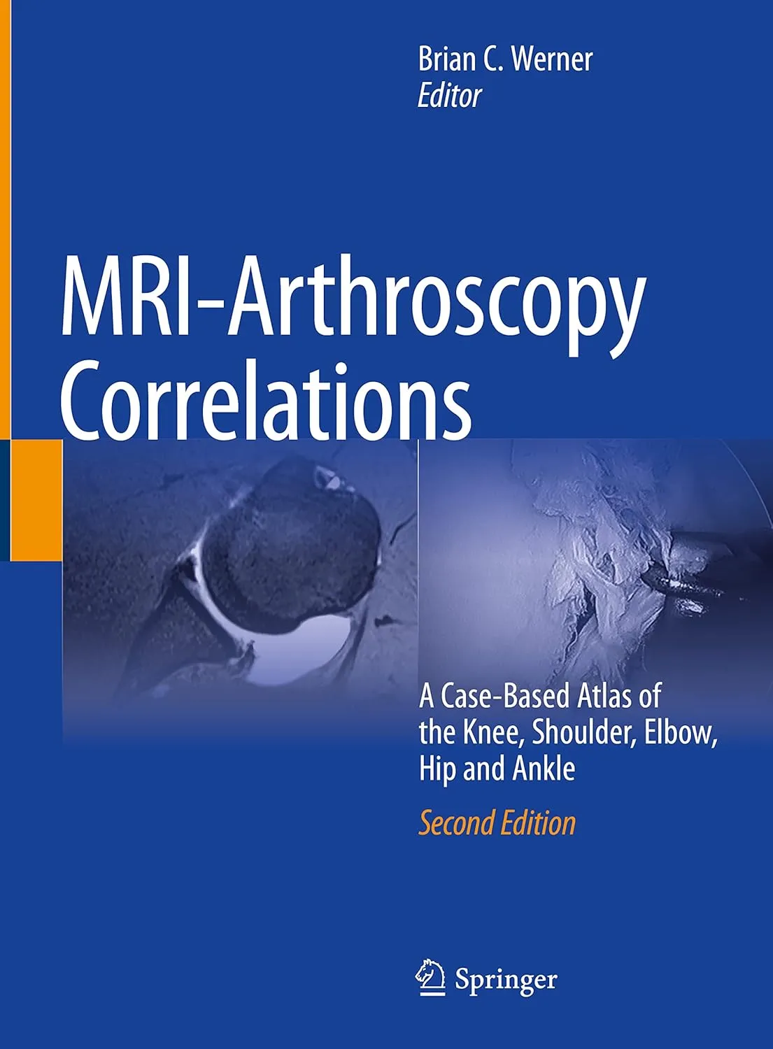 MRI Arthroscopy Correlations A Case Based Atlas Of The Knee Shoulder Elbow Hip And Ankle 2nd Edition | Hardcover