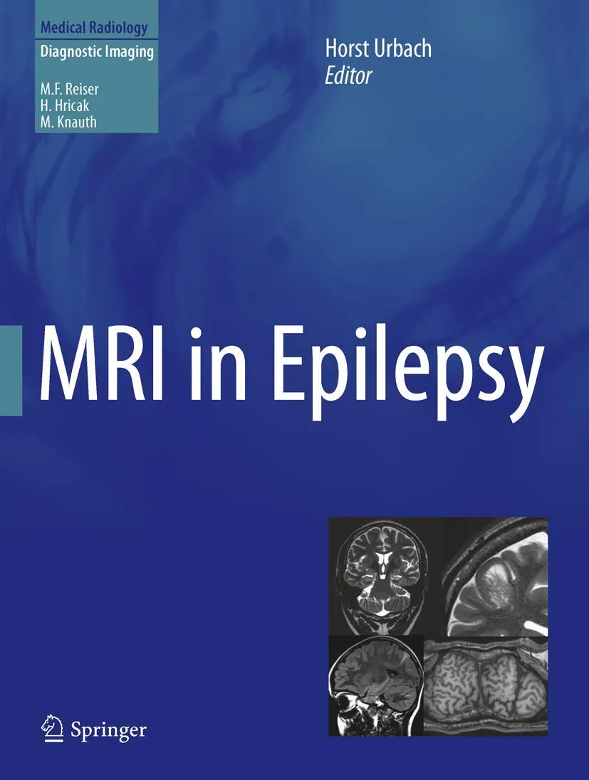 MRI in Epilepsy | Hardcover
