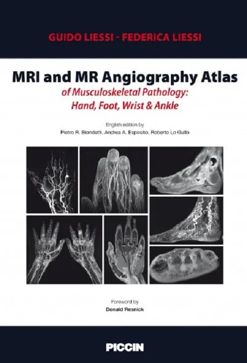 MRI and MR Angiography Atlas of Musculoskeletal Pathology Hand Foot Wrist and Ankle | Hardcover