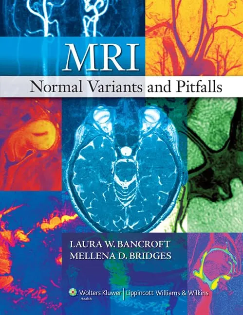 MRI Normal Variants and Pitfalls | Hardcover
