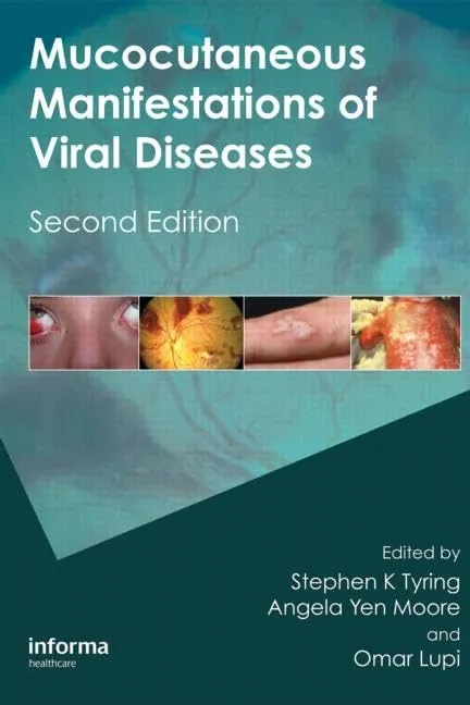 Mucocutaneous Manifestations of Viral Diseases | 2nd Edition | Hardcover