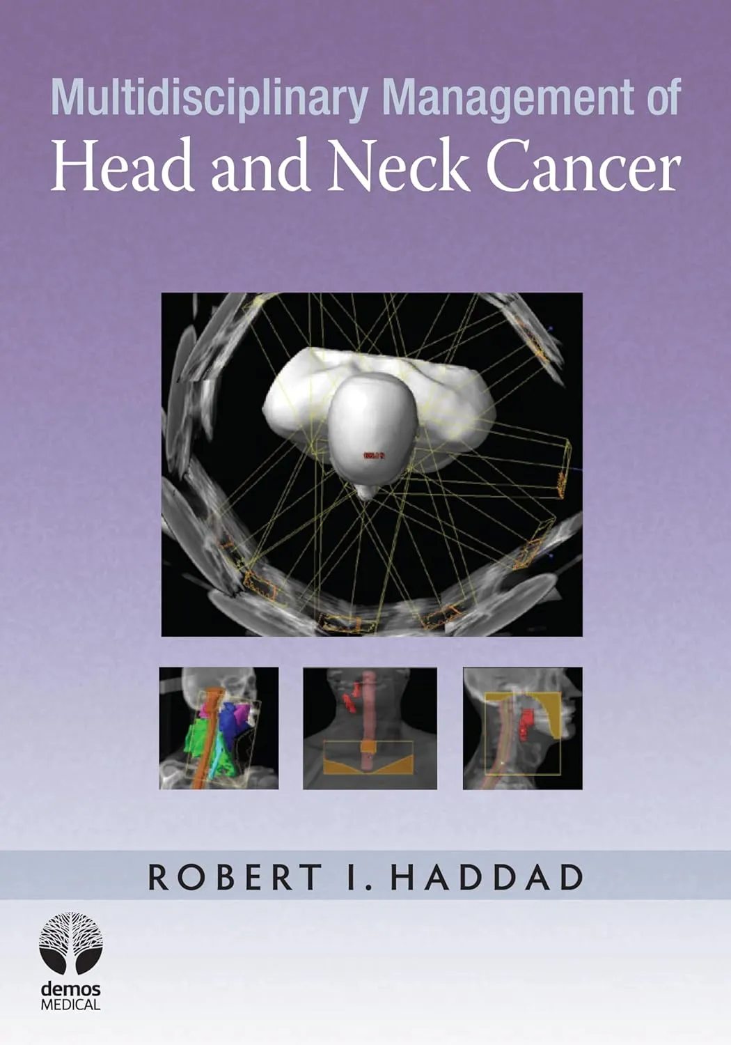 Muldisciplinary Management of Head and Neck Cancer | Hardcover