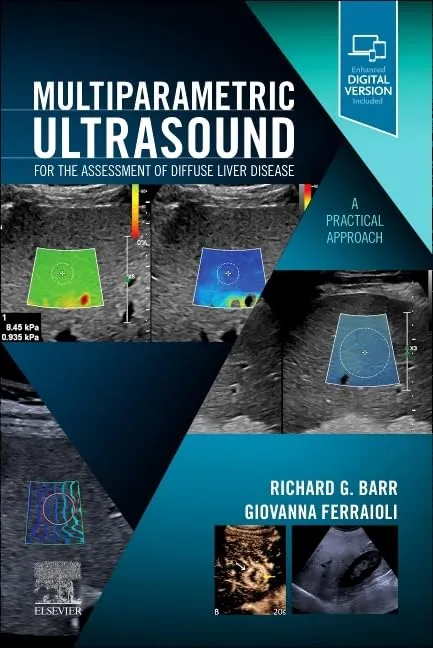 Multiparametric Ultrasound For The Assessment Of Diffuse Liver Disease With Access Code | Paperback