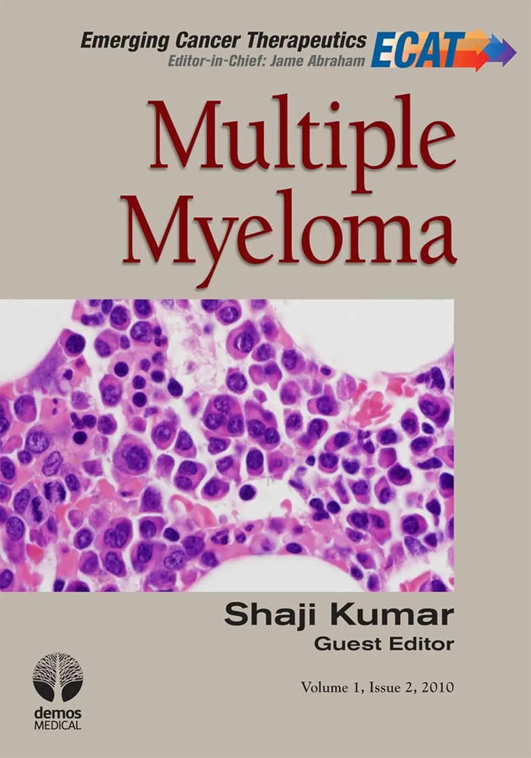 Multiple Myeloma | Hardcover