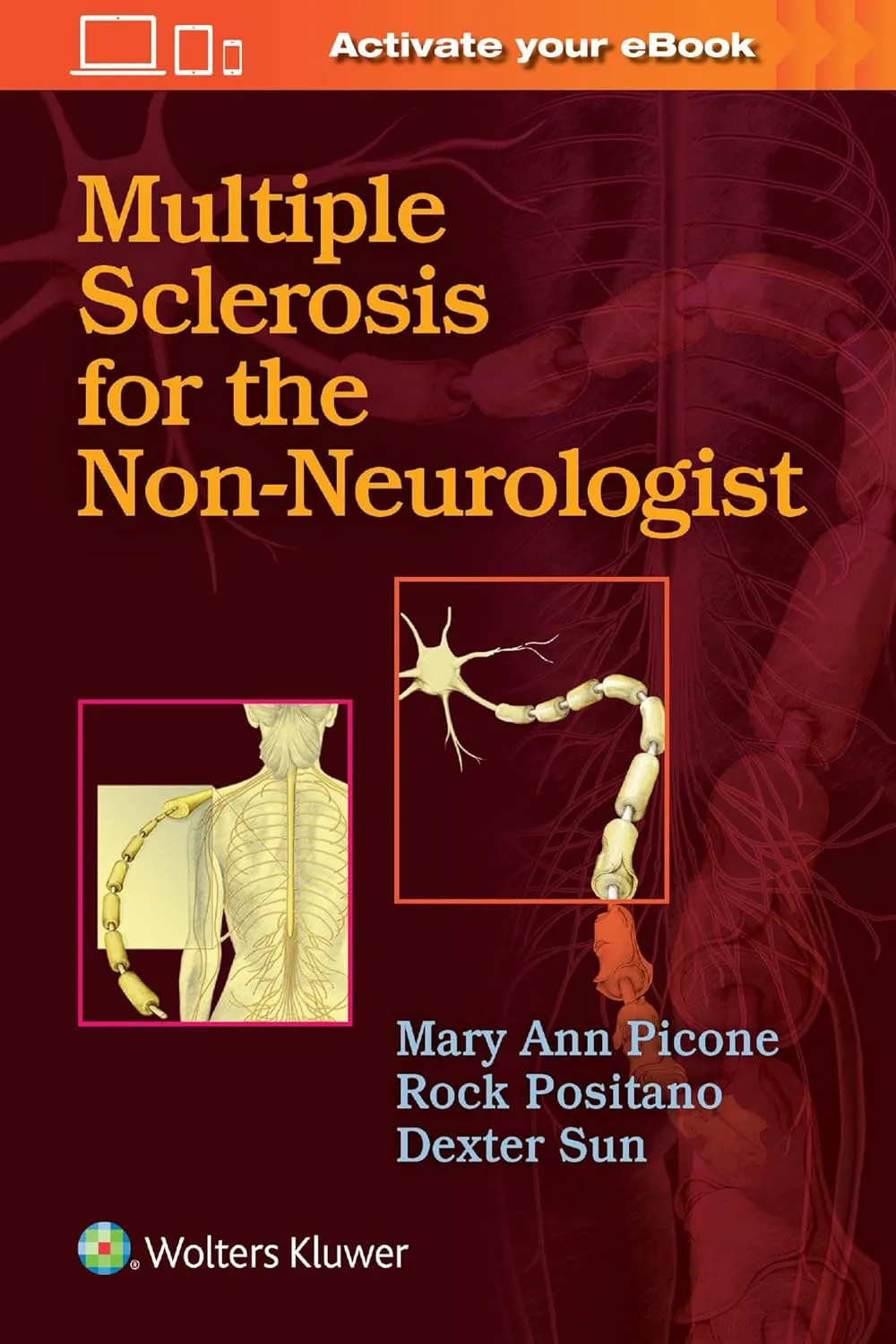 Multiple Sclerosis for the Non-Neurologist | Paperback