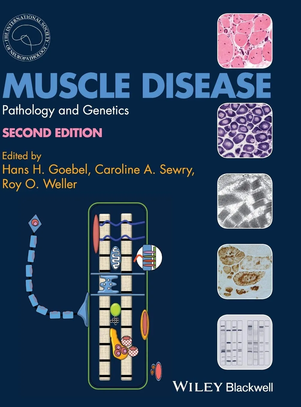 Muscle Disease Pathology and Genetics | 2nd Edition | Hardcover
