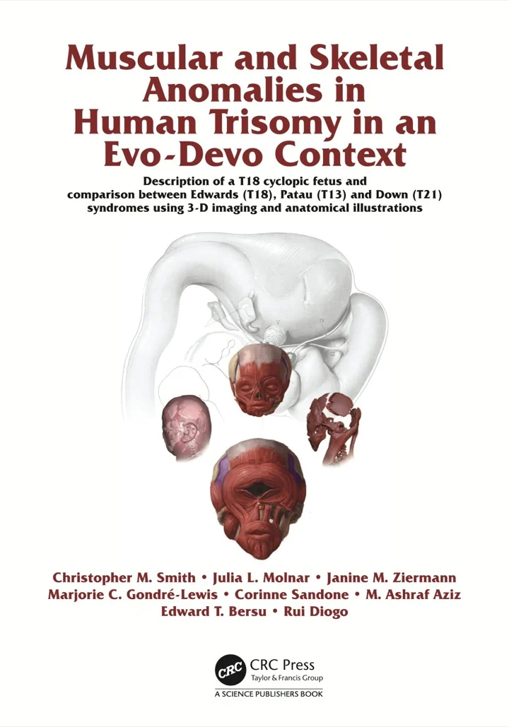 Muscular and Skeletal Anomalies in Human Trisomy in an Evo-Devo Context | Hardcover