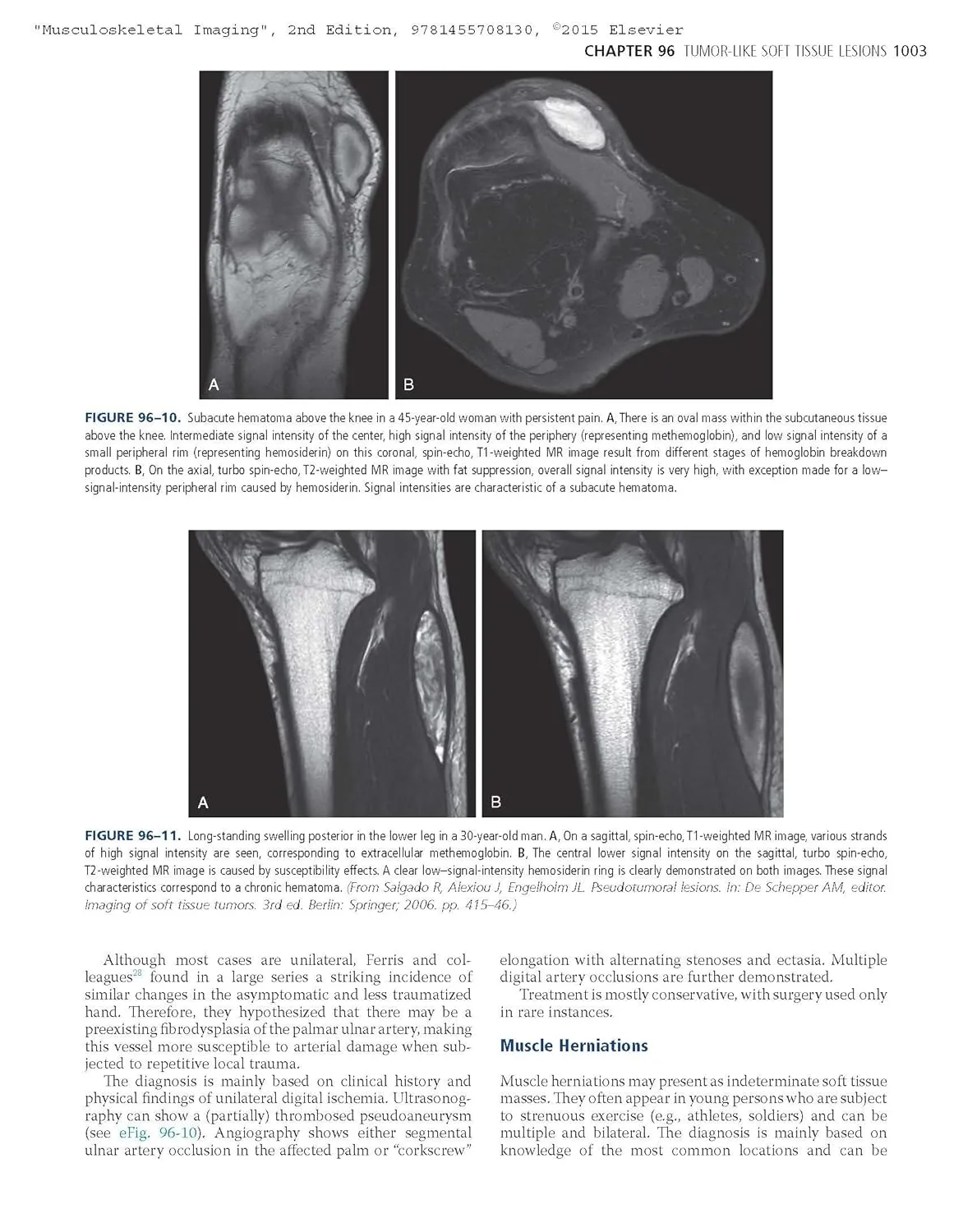 Musculoskeletal Imaging | 2nd Edition | Hardcover