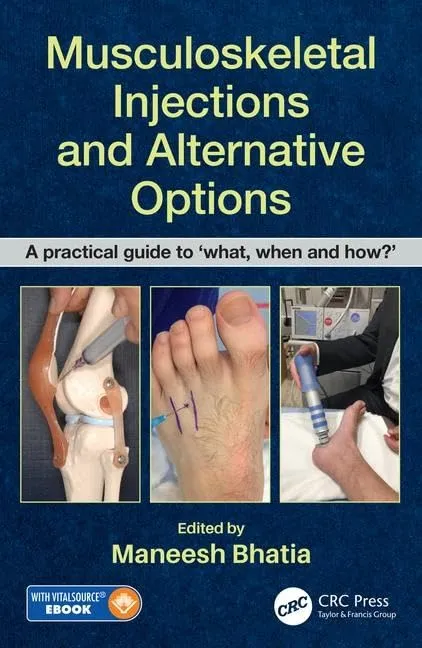 Musculoskeletal Injections and Alternative Options | Hardcover