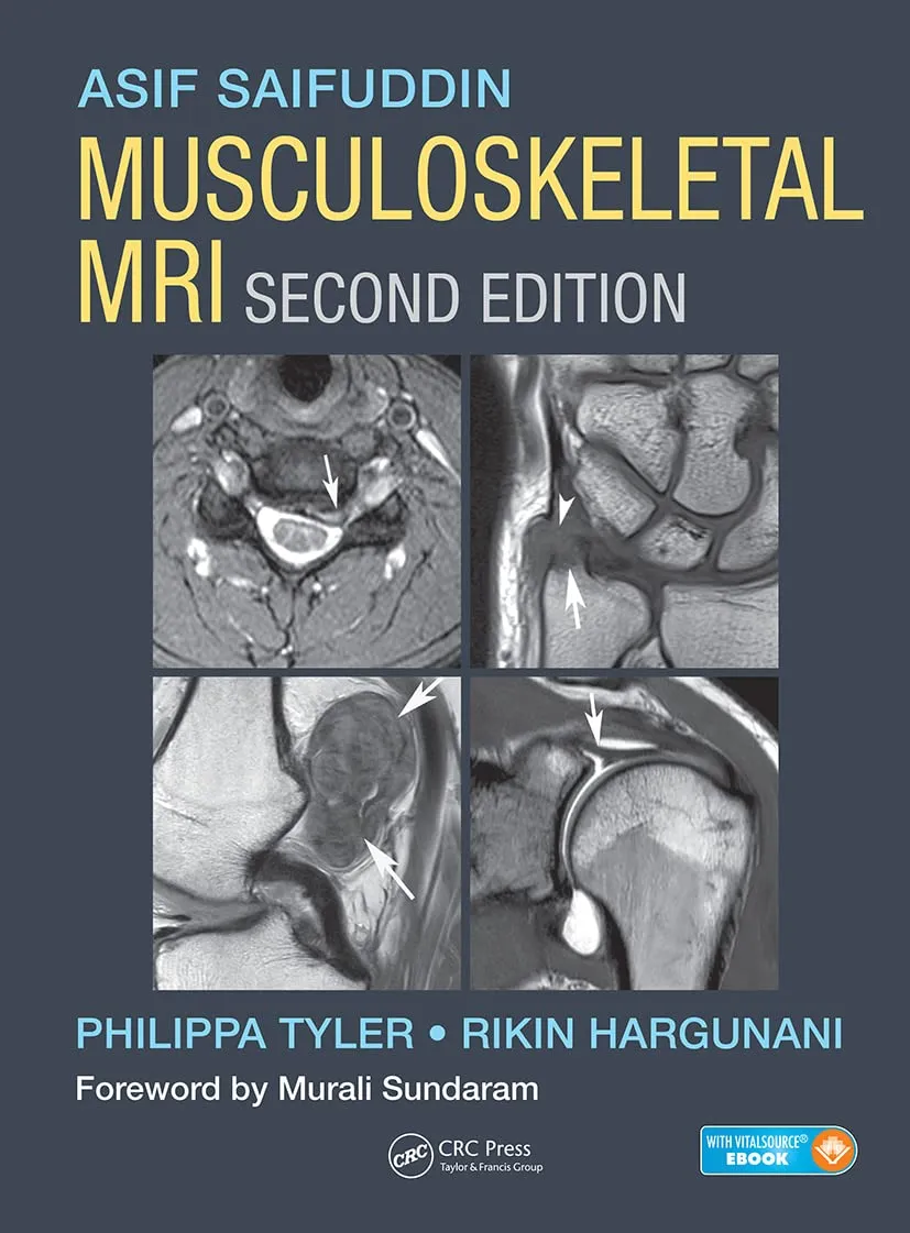 Musculoskeletal MRI | 2nd Edition | Hardcover