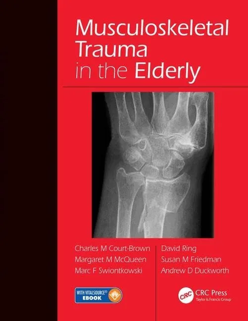 Musculoskeletal Trauma in the Elderly | Hardcover